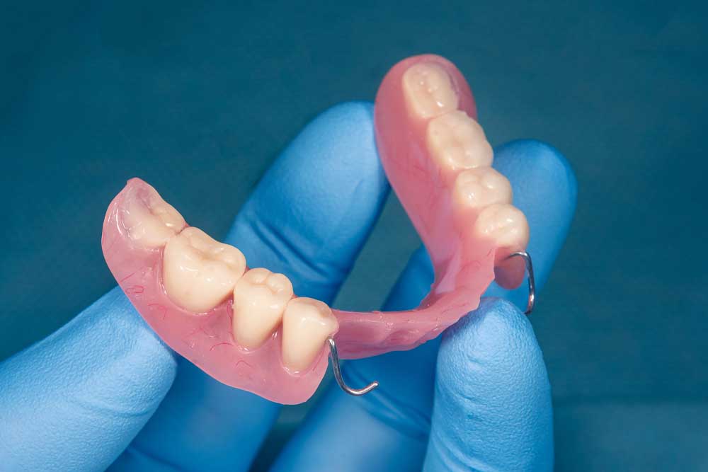 Removable partial dentures from Pecan Tree Family Dentistry in McKinney, TX