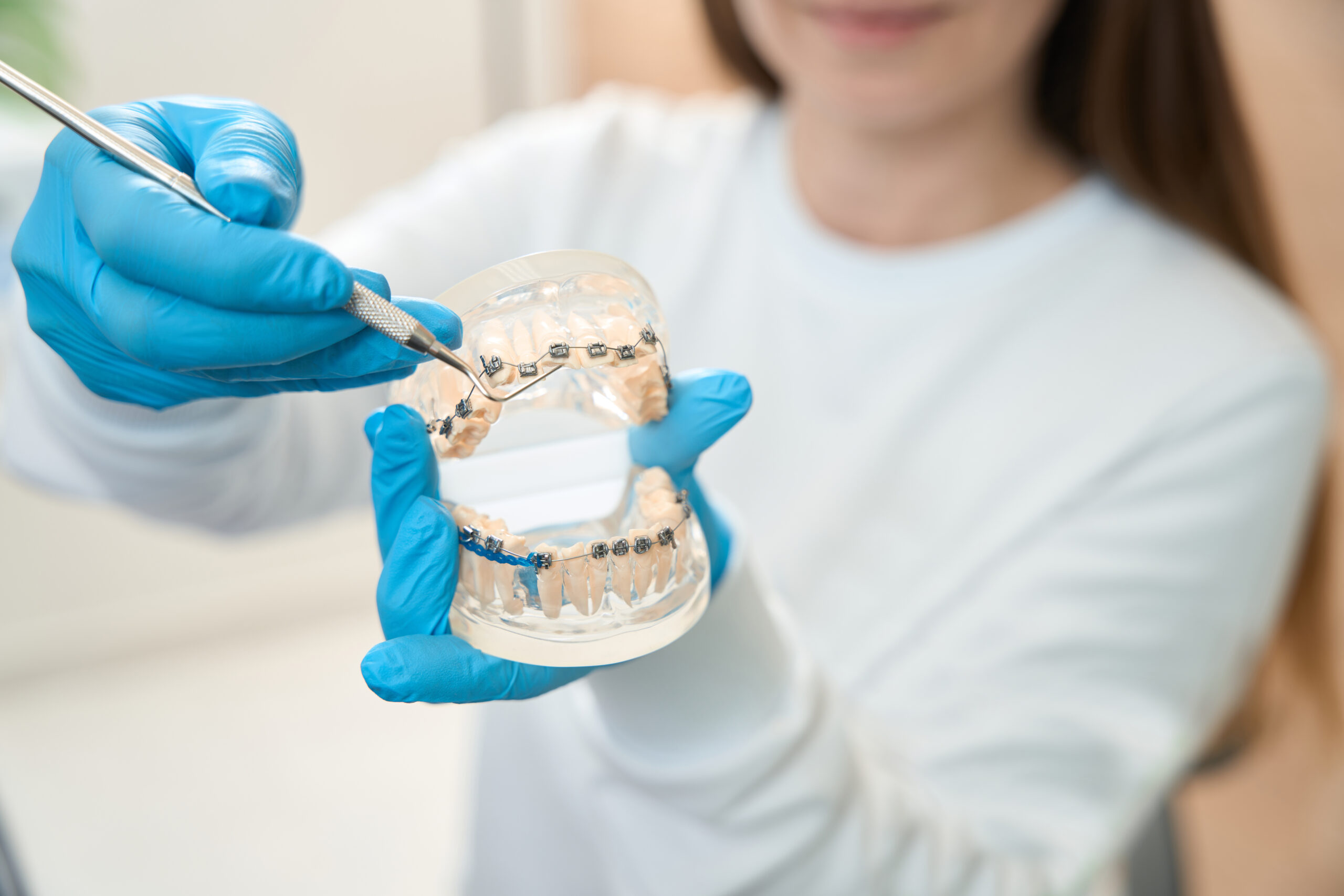 Invisalign clear aligners for straightening teeth, offered by Pecan Tree Family Dentistry in McKinney, TX.