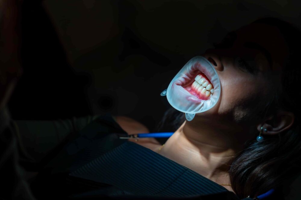 Patient undergoing a dental examination with lips retracted to reveal gumline and tooth structure