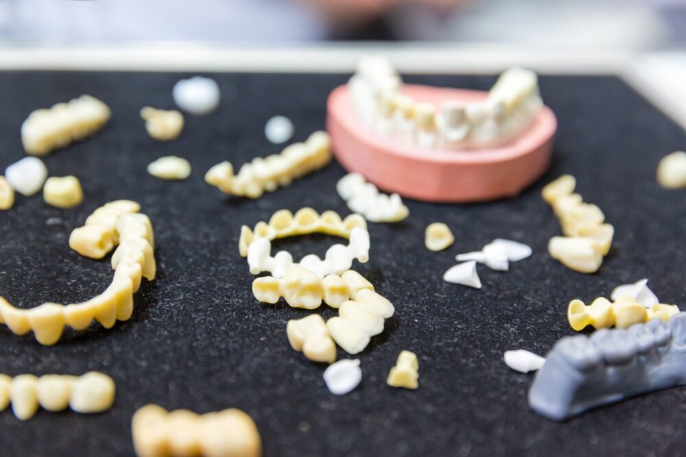 Assorted dental bridge components and prosthetic models on a dark surface at a dental lab