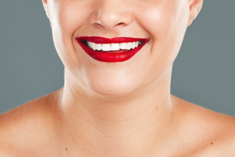 Close-up of a woman smiling with bright white teeth and red lipstick after whitening treatment